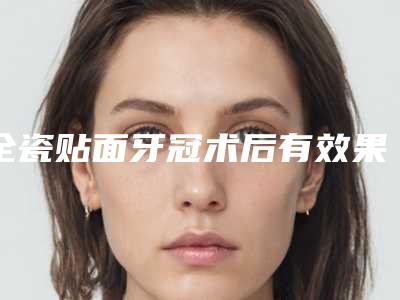 全瓷贴面牙冠术后有效果吗